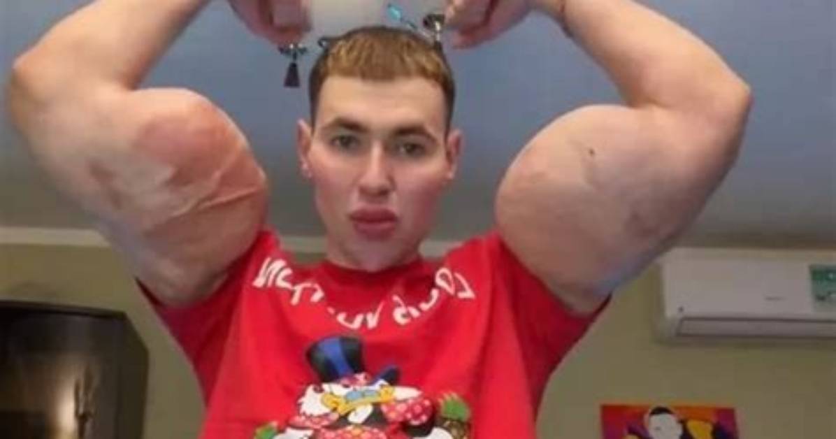 Kirill Tereshin Biography Age Fiancee Net Worth Surgery Fight And