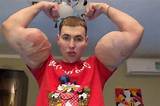 Kirill Tereshin Biography, Age, Fiancee, Net Worth, Surgery, Fight and Arms