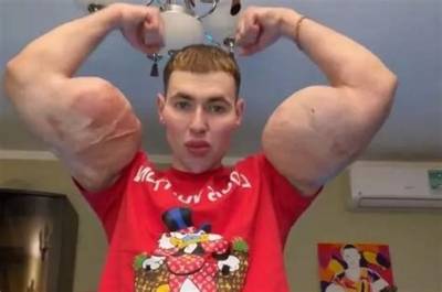 Kirill Tereshin Biography, Age, Fiancee, Net Worth, Surgery, Fight and Arms