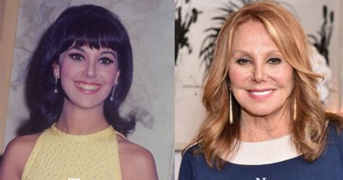 Know About Marlo Thomas Face Lift Plastic Surgery Before and After Kids And