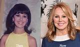 Know About Marlo Thomas Face Lift: Plastic Surgery Before and After, Kids and Husband