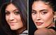 Kylie Jenner Before Surgery and After Surgery: a Comprehensive Transformation Analysis