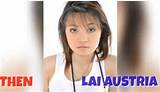 Lai Austria Real Gender: Before and After Surgery