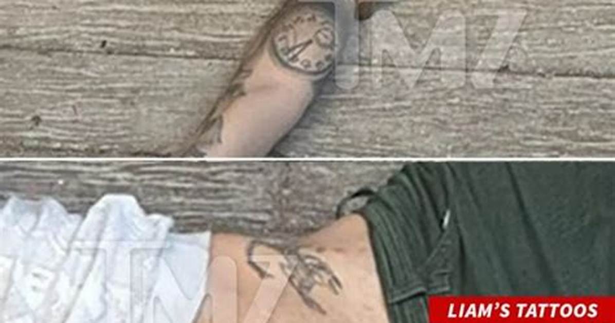 Liam Payne Arm Injury: How Did He Break His Arm?