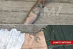 Liam Payne Arm Injury: How Did He Break His Arm?