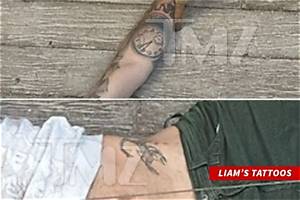 Liam Payne Arm Injury: How Did He Break His Arm?