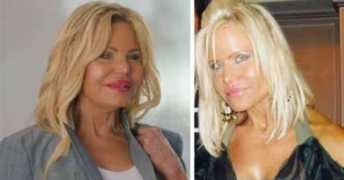 Lisa Helou's Plastic Surgery Journey Revealed