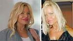 Lisa Helou's Plastic Surgery Journey Revealed