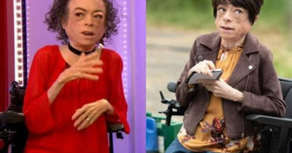 Liz Carr Height Age Boyfriend Biography Wiki Net