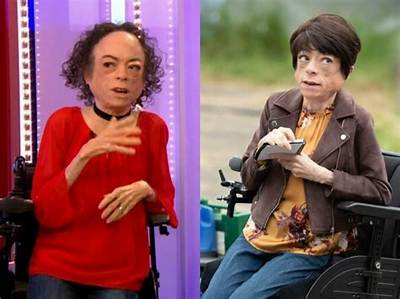 Liz Carr Height, Age, Boyfriend, Biography, Wiki, Net Worth