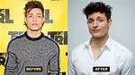 Matt Rife Before Surgery: Uncovering the Journey