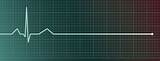 Meaning of Flatline by 5 Seconds of Summer