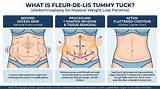 Meaning of Tummy Tuck (Xxx “Lick” Verse) by Xxxtentacion