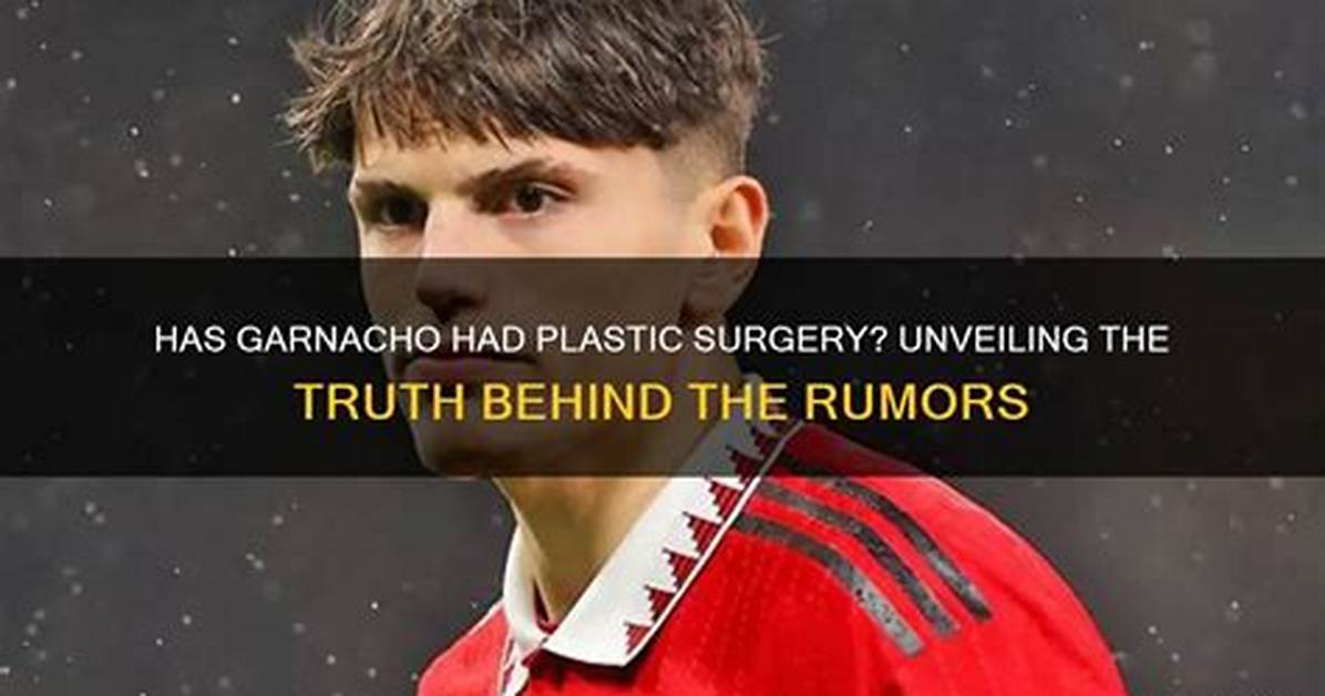 Meet Garnacho the Plastic Surgery