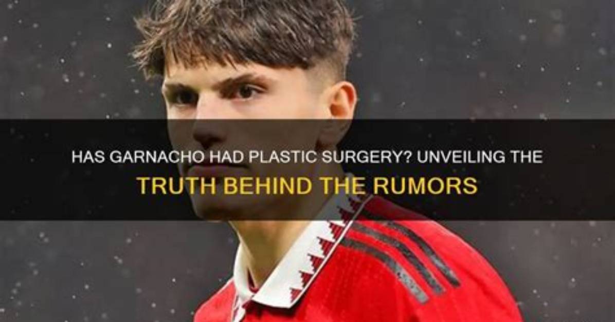 Meet Garnacho the Plastic