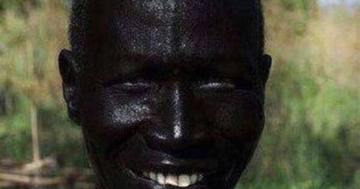 Meet the Darkest Man Alive: a True Story of Melanin and Medical Marvels