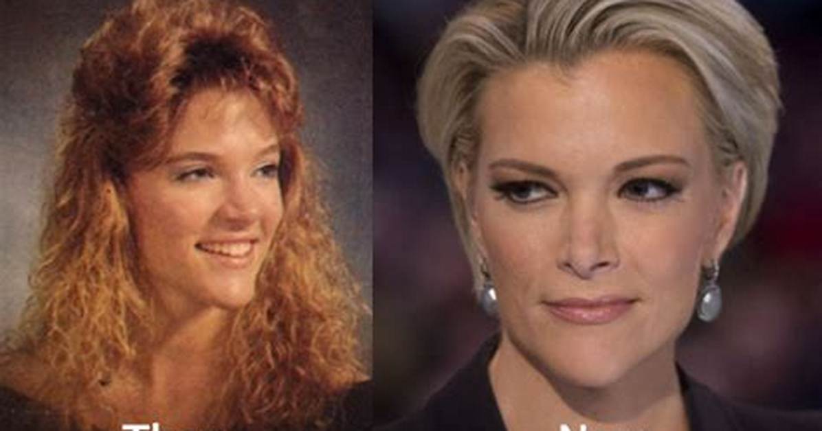 Megyn Kelly Plastic Surgery: Before & After Photos?