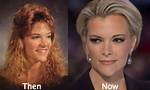 Megyn Kelly Plastic Surgery: Before & After Photos?