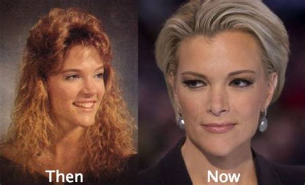 Megyn Kelly Plastic Surgery: Before & After Photos?