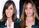 Melissa Rivers Plastic Surgery Journey Transformation: a Candid Look