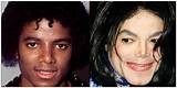 Michael Jackson Before and After Pepsi Accident Transformation