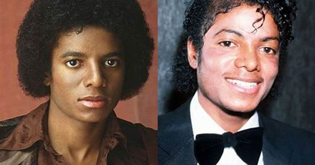 Michael Jackson Before and After Pepsi
