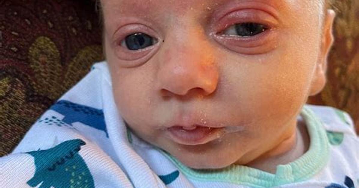 Mom Shares Terrifying Video of Baby Trying to Breathe, Warns of Rsv Symptoms as He Is Hospitalized