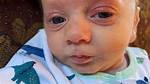 Mom Shares Terrifying Video of Baby Trying to Breathe, Warns of Rsv Symptoms as He Is Hospitalized