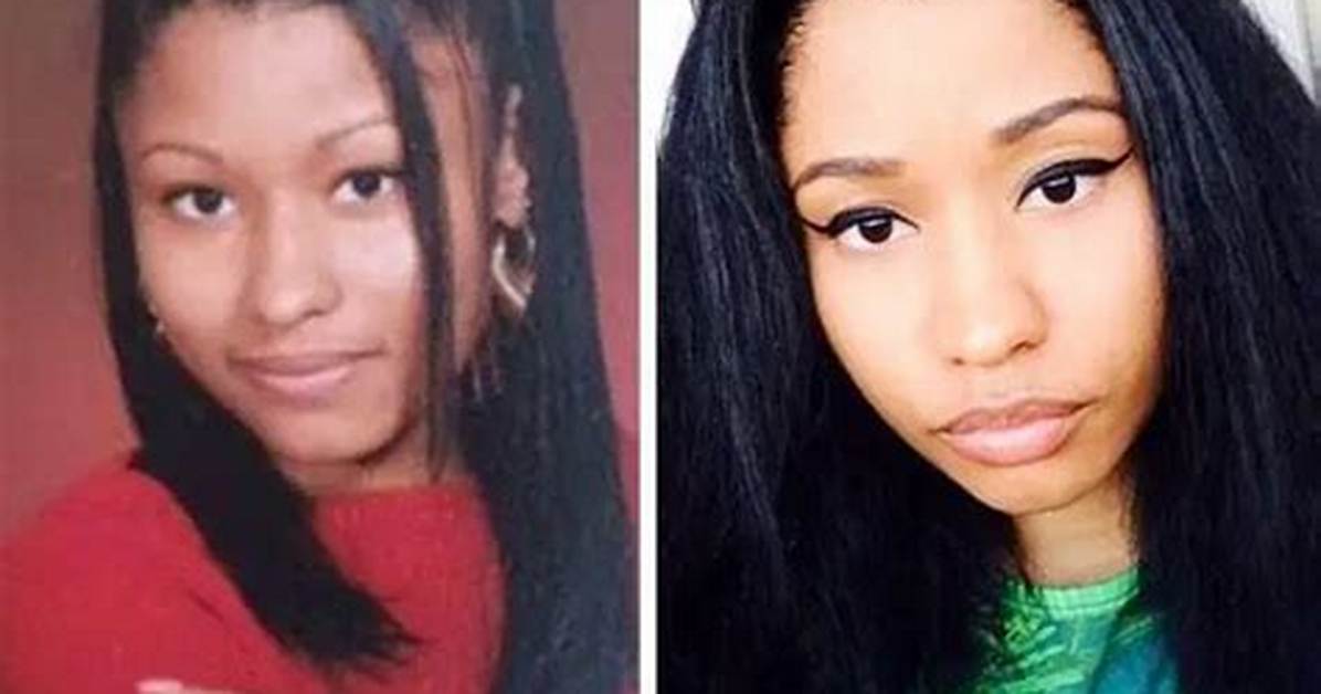 Nicki Minaj Before Any Surgery a Journey Through Her Early Life And