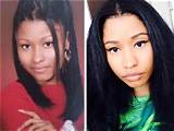 Nicki Minaj Before Any Surgery: a Journey Through Her Early Life and Transformation