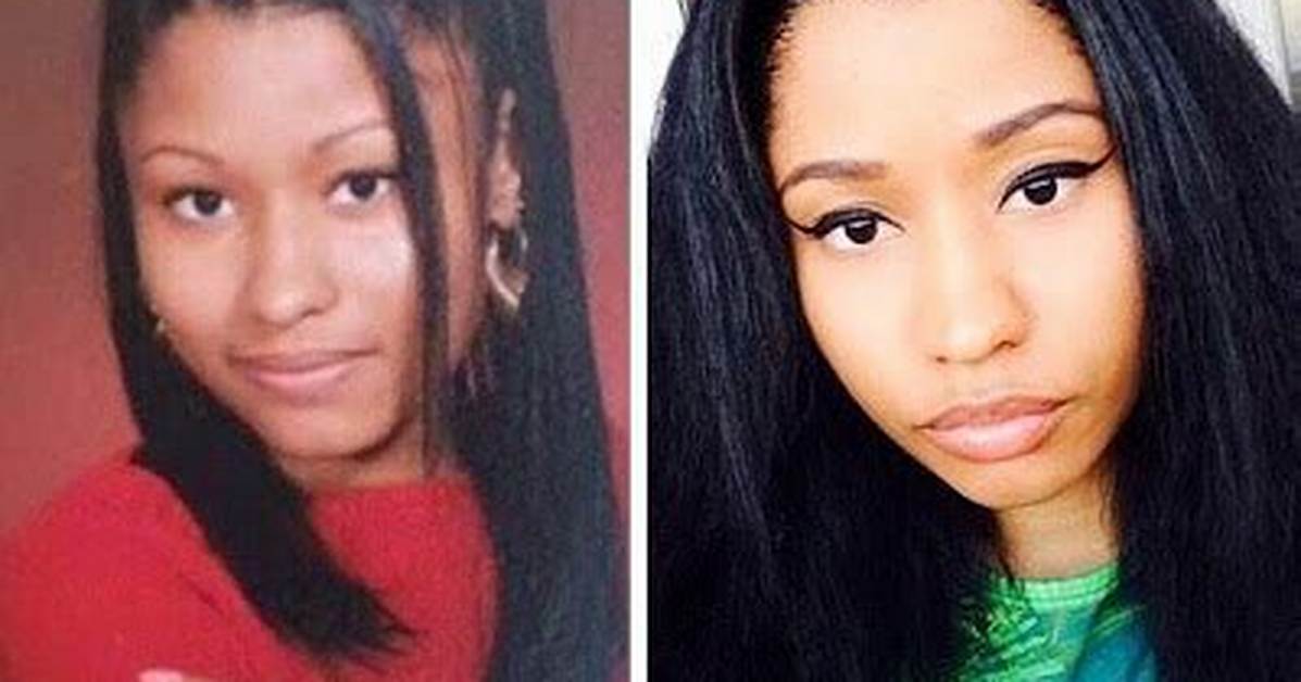 Nicki Minaj Before She Got Surgery: the Untold Story of Her Transformation