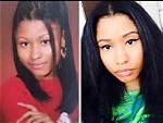 Nicki Minaj Before She Got Surgery: the Untold Story of Her Transformation