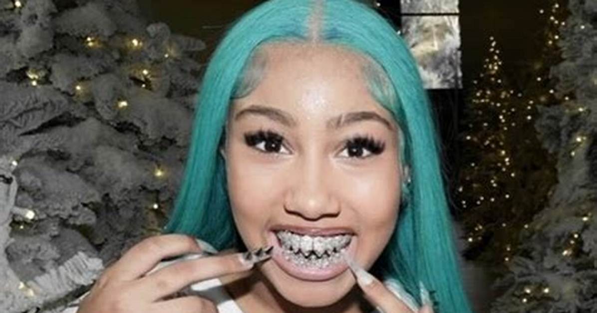 North West Grillz: the Ultimate Guide to Elevate Your Style
