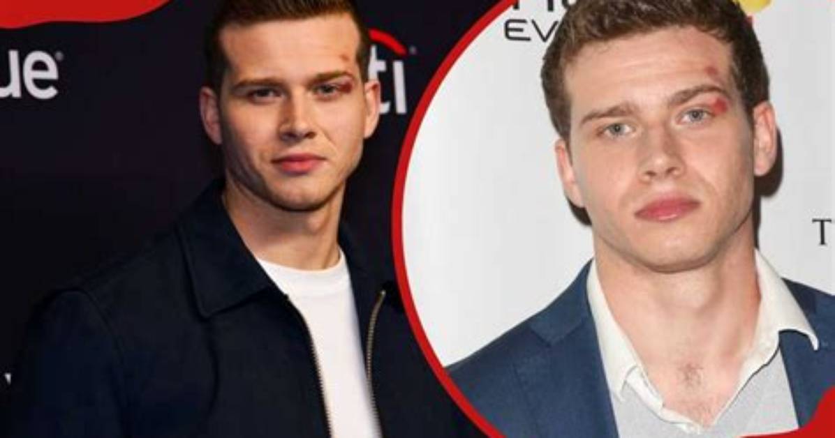 Oliver Stark's Relationships: Past & Present