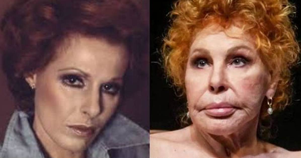 Ornella Vanoni Plastic Surgery Transformation over the Year's