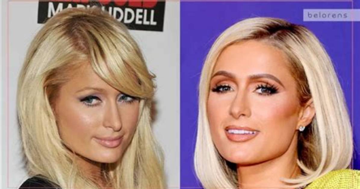 Paris Hilton S Nose Exploring the Evolution of Her Signature