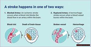 Pioneer Woman's Stroke: Updates & Resources