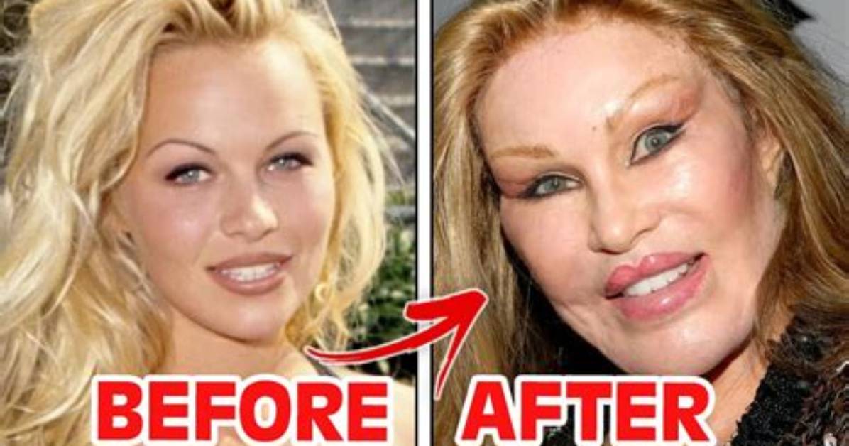 Plastic Surgery Before and After Insights