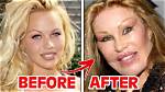 Plastic Surgery Before and After Insights