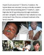 Remembering the Tragic Case of Hisashi Ouchi: a Devastating Radiation Accident