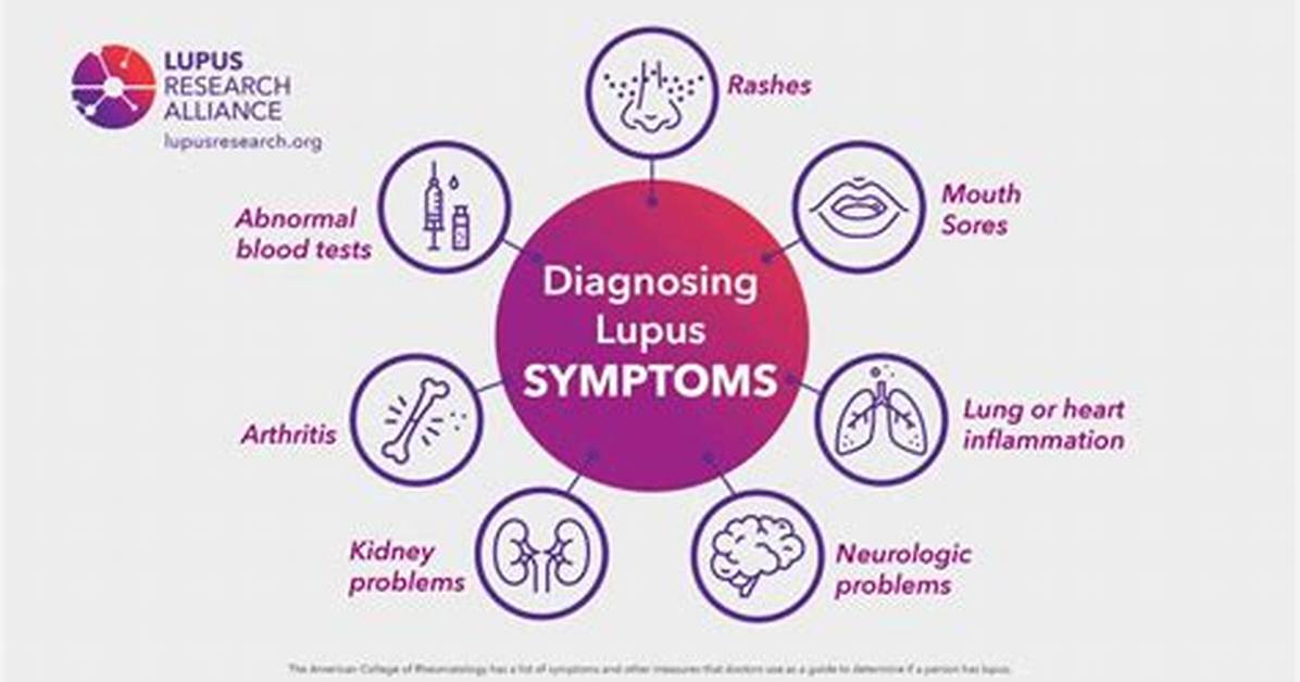Researching Lupus Can