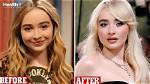 Sabrina Carpenter's Journey with Botox: a Comprehensive Guide