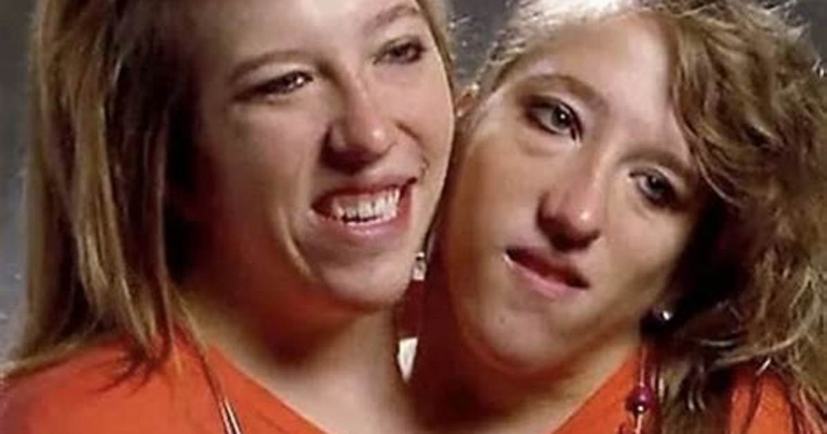 Sad News: Abby and Brittany Hensel's Family Speaks Out