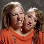 Sad News: Abby and Brittany Hensel's Family Speaks Out