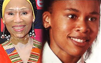 Sarafina Real? Leleti Khumalo’s Skin: What Happened?