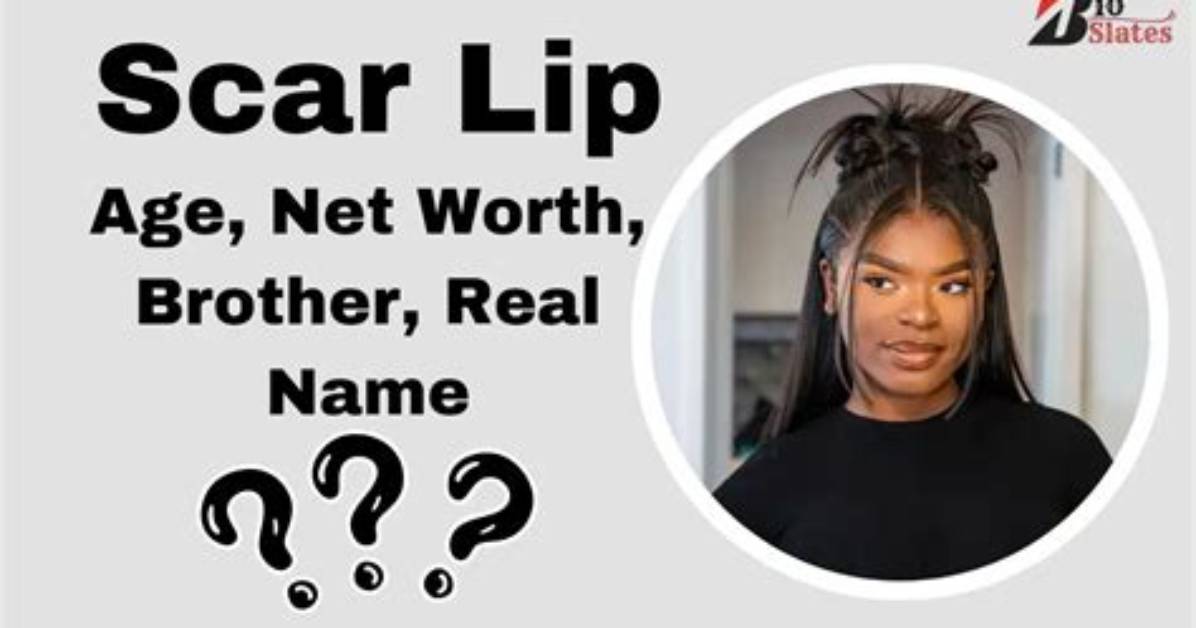 Scar Girl Height Weight Net Worth Age Birthday Wikipedia Who