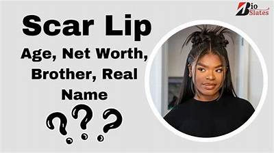 Scar Girl Height, Weight, Net Worth, Age, Birthday, Wikipedia, Who, Instagram, Biography
