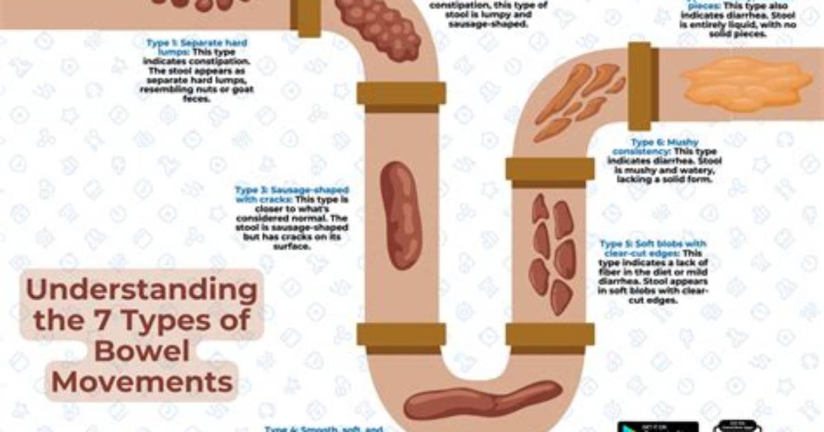 Should Bowel Movements Be Hard or Soft?