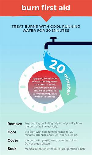 Should You Put Cold Water on a Burn?