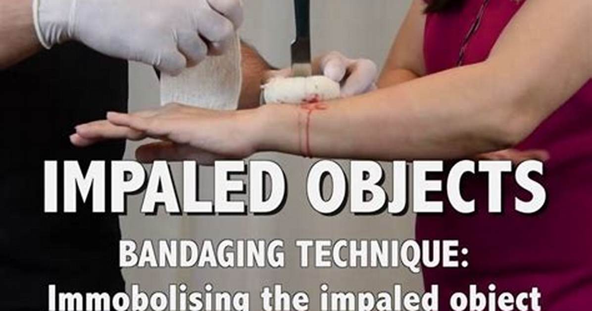 Should You Remove Impaled Object?